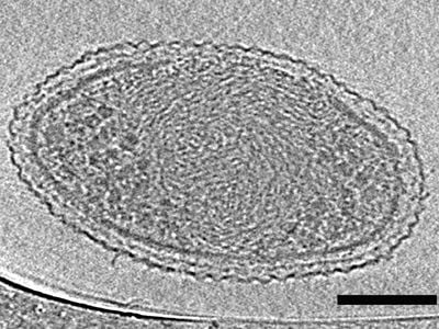 More than 150,000 of these tiny bacterial cells could fit onto the tip of a human hair. 