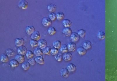 On the left are one type of Myxozoan-- spores of Kudoa iwatai--microorganisms recently reclassified as a member of the same group that includes jellyfish like the Aurelia aurita (moon jelly) on the right.