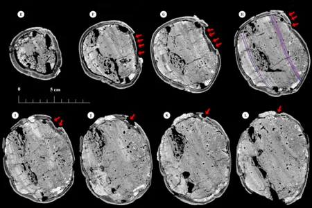 The skull was fractured on its front and left side.