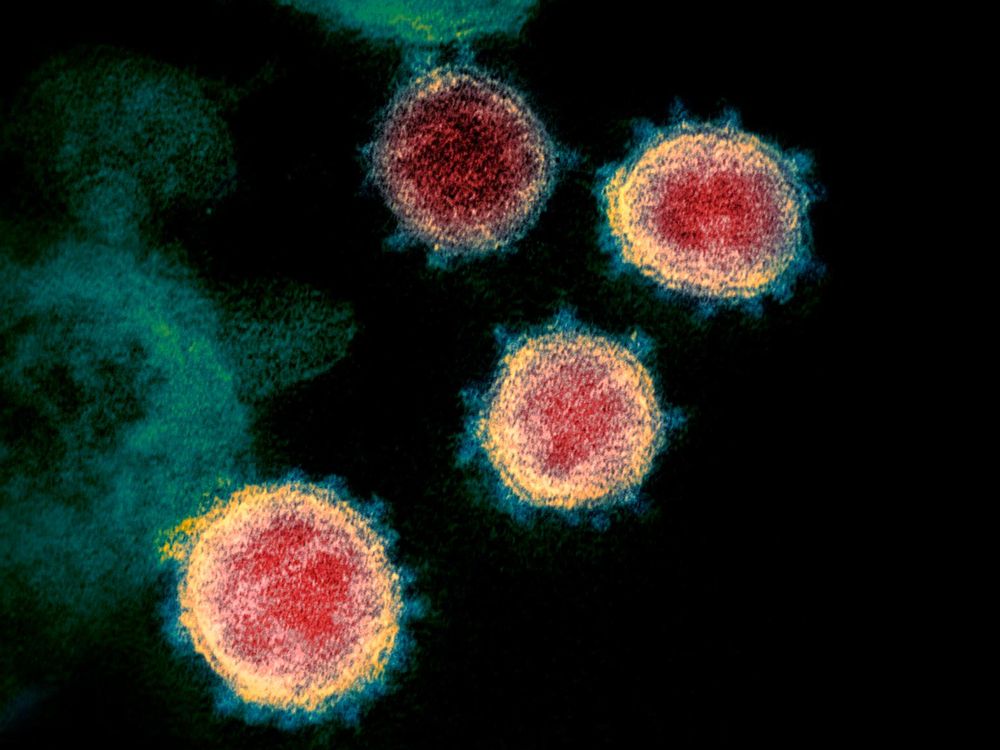 coronavirus.jpg