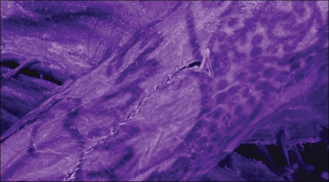 dark tattoos are visible against skin with a purple tint from imaging