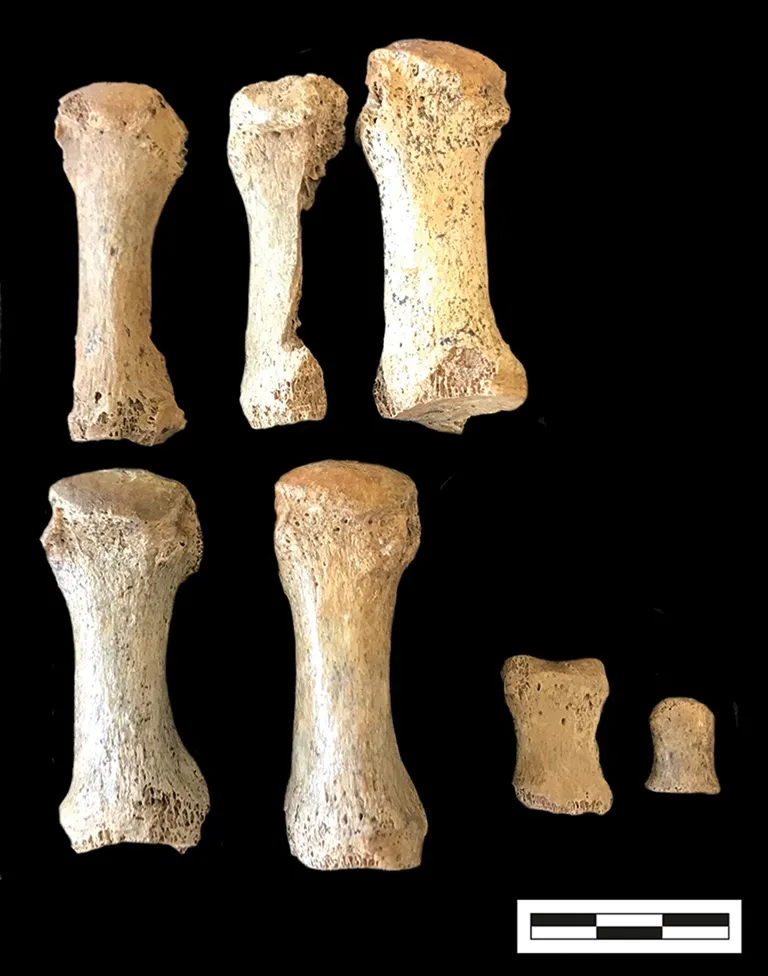 toe