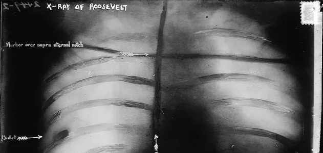 Roosevel_xray.jpg