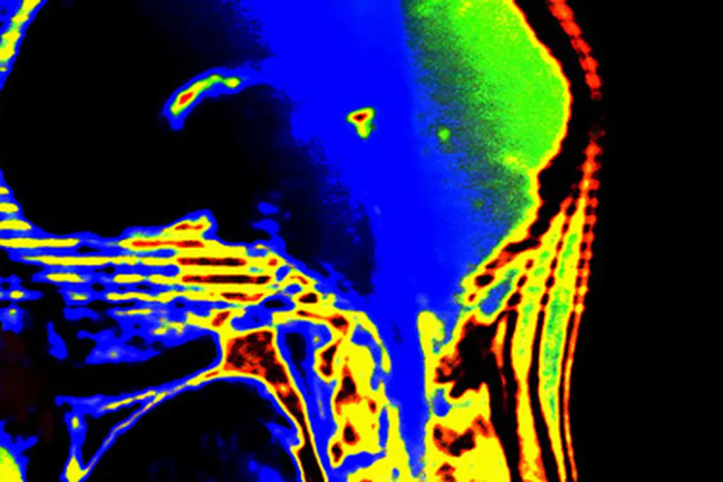 How does free will function in the brain?