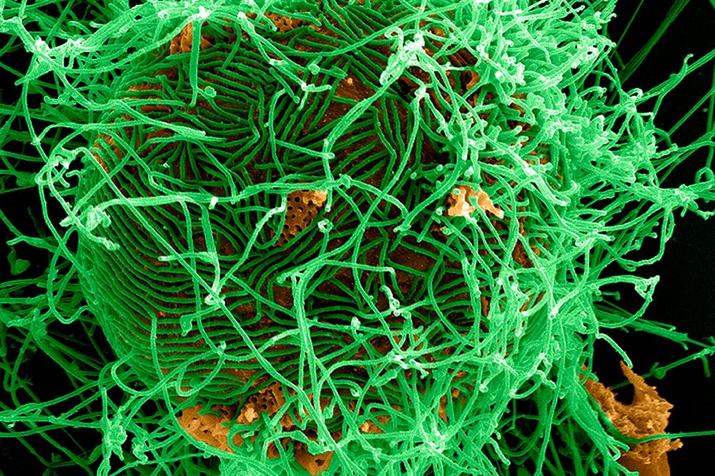 ebola virus