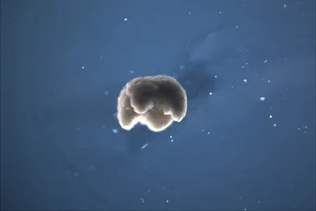 Using AI, supercomputers and a Frankenstein approach, scientists designed living robots from frogs' stem cells.