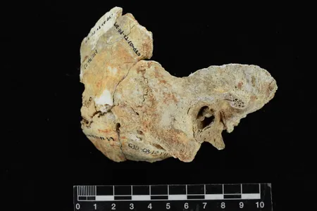 The bony growths found in pre-Hispanic skulls in Panama suggest communities were diving for oysters and pearls thousands of years ago. 