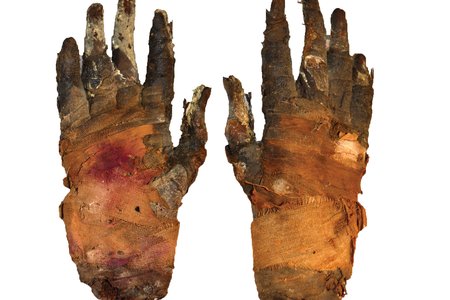 Swedish researchers used phase-contrast imaging to examine the soft tissue of a 2,400-year-old mummified hand