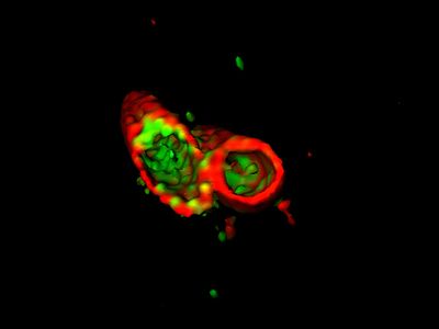 Before killing Salmonella, the detergent-like protein APOL3 (green) must get through the bacteria's protective outer membrane (red).
