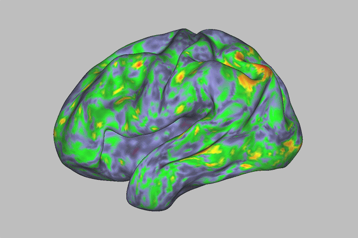 A gif of a brain with different sections changing color between green, yellow, orange and red