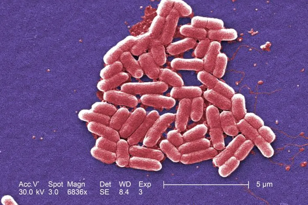 E. coli bacteria shown under a microscope at 6836X magnification