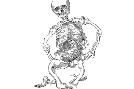 Rickets, a disease caused by vitamin D deficiency that results in skeletal deformities, has been traced back to the Roman Empire. 