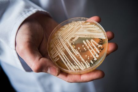Candida auris