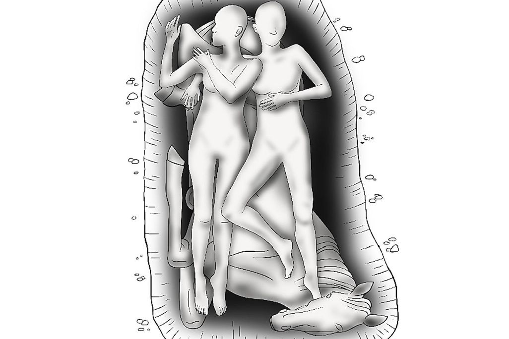 reconstruction