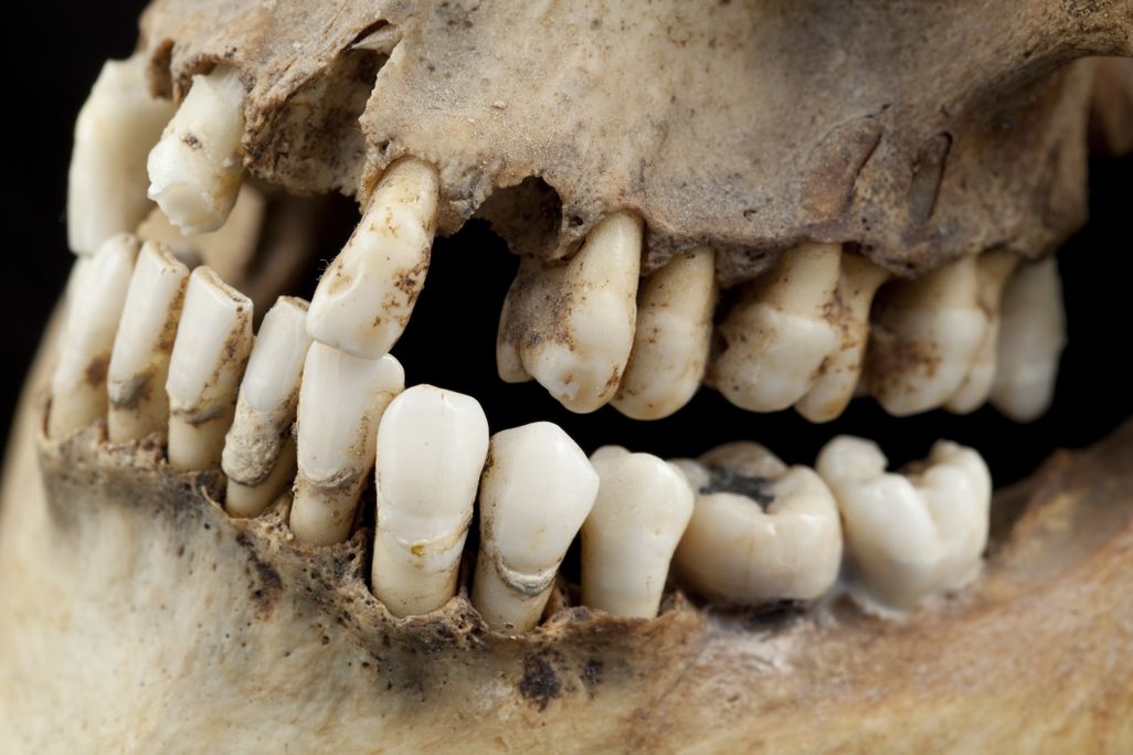 Ancient teeth