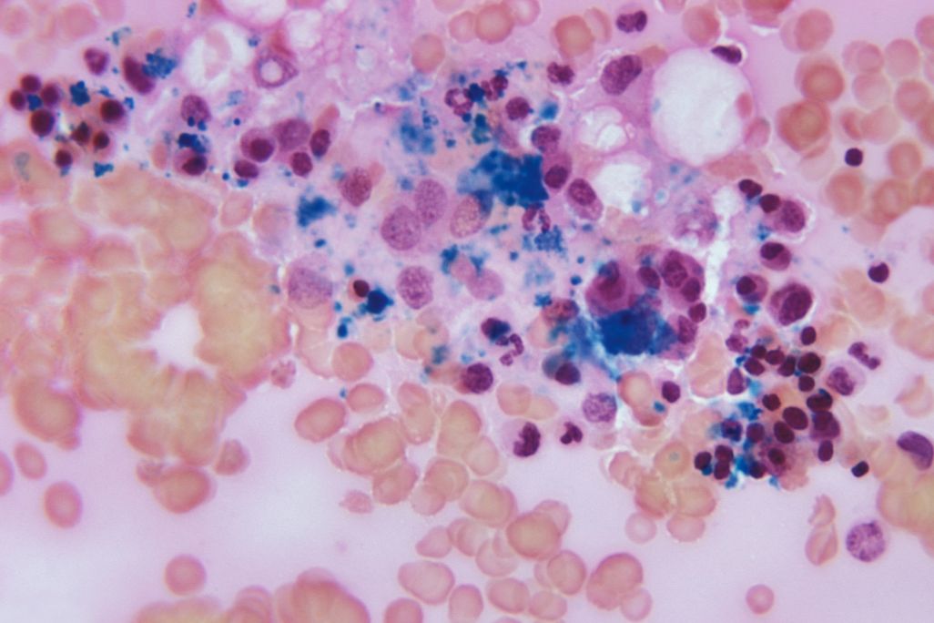 An image taken through a microscope of bone marrow tissue.