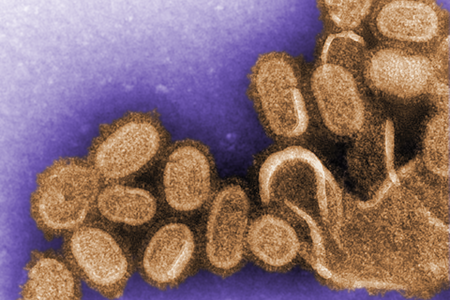 This digitally-colorized negative-stained transmission electron microscopic (TEM) image shows recreated 1918 influenza virions that were collected from supernatants of 1918-infected Madin-Darby Canine Kidney (MDCK) cells cultures 18 hours after infection.