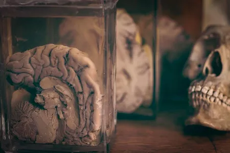 This brain is just one of many making up the Indiana Medical History Museum's extensive collection. 