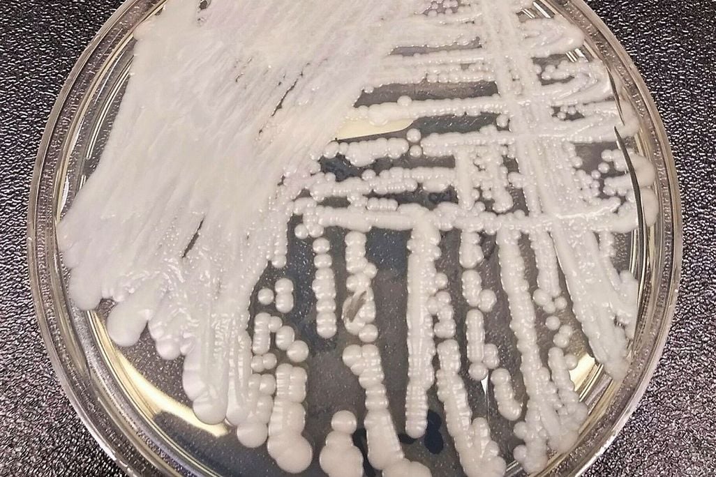 An upclose photo of a petri dish innoculated with <i>C. auris<i/>