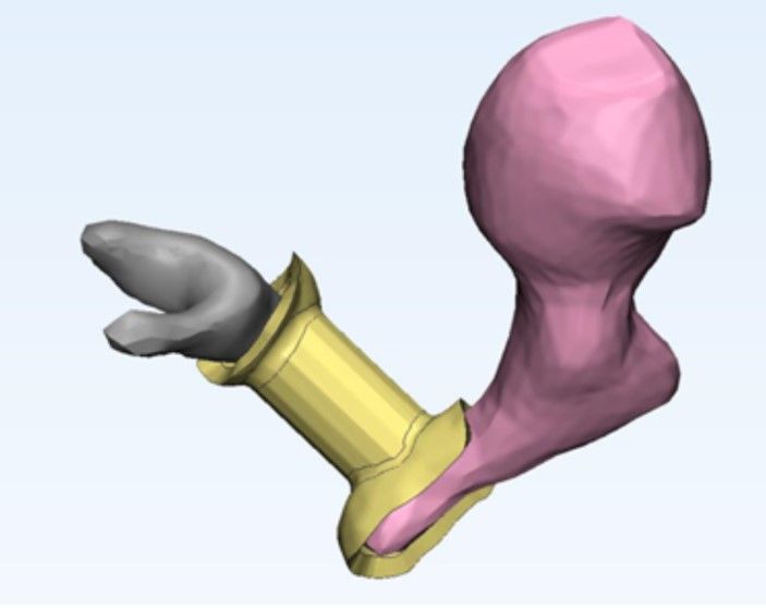 Doctors Are 3D Printing Ear Bones To Help With Hearing Loss