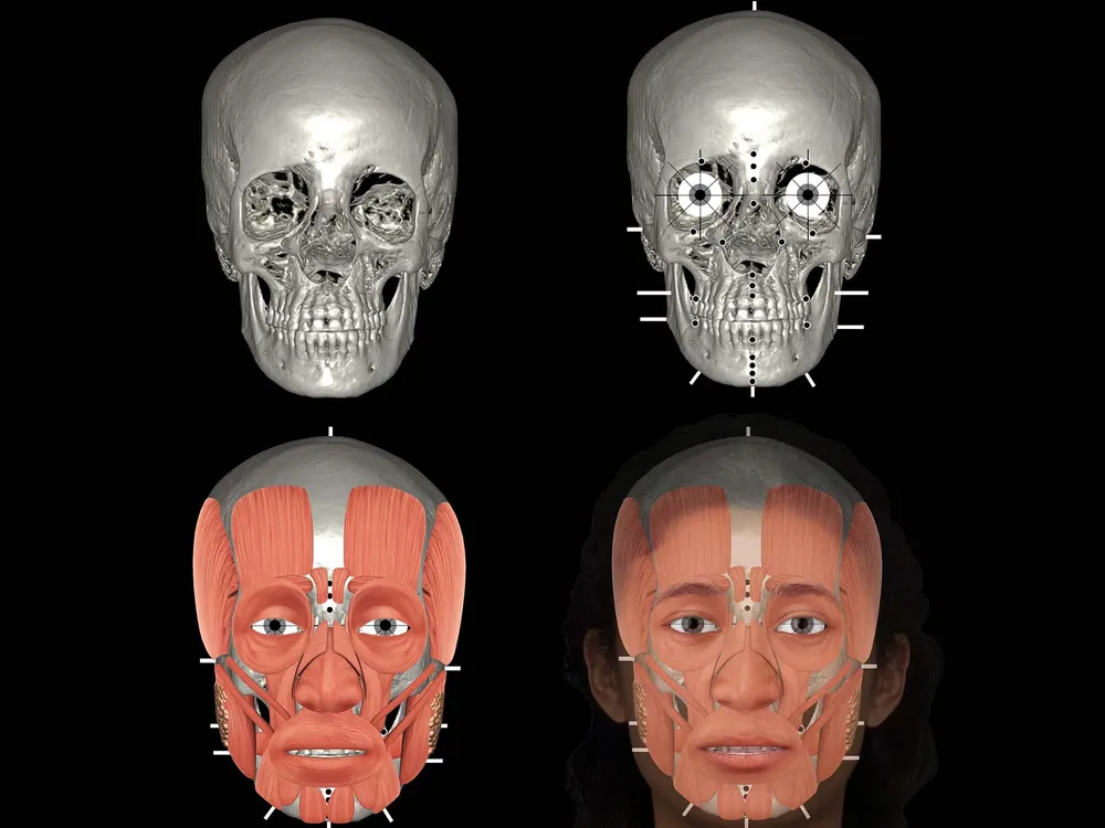 illustrated forensic skulls