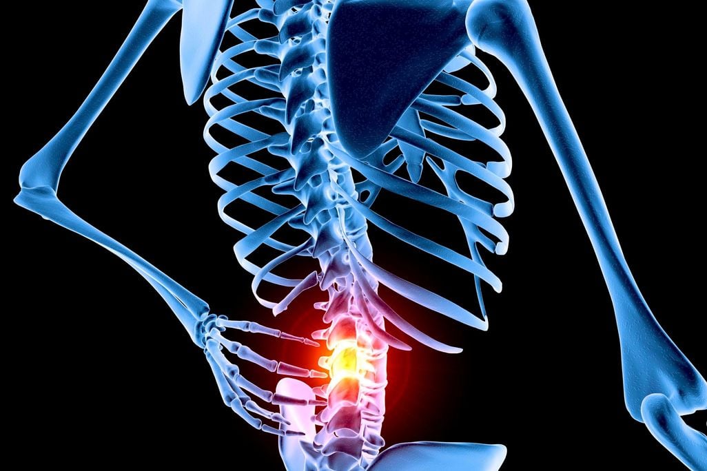 Lower Back Pain