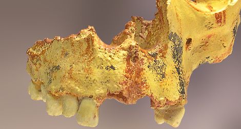 A partial Homo antecessor skull