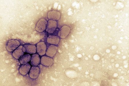 A cluster of variola viruses viewed under an electron microscope. Strains of the variola virus cause smallpox disease.