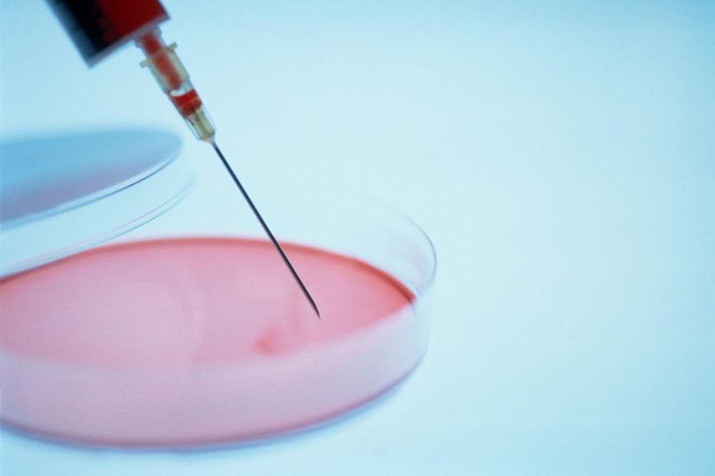 petri dish