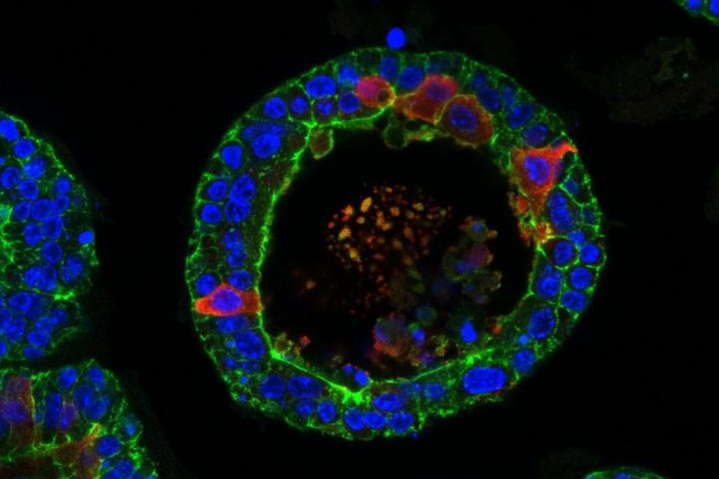  tear gland organoids