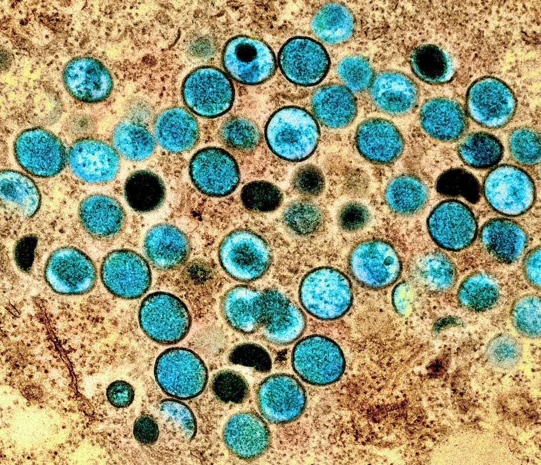 Colorized transmission electron micrograph of monkeypox virus particles (teal) cultivated and purified from cell culture