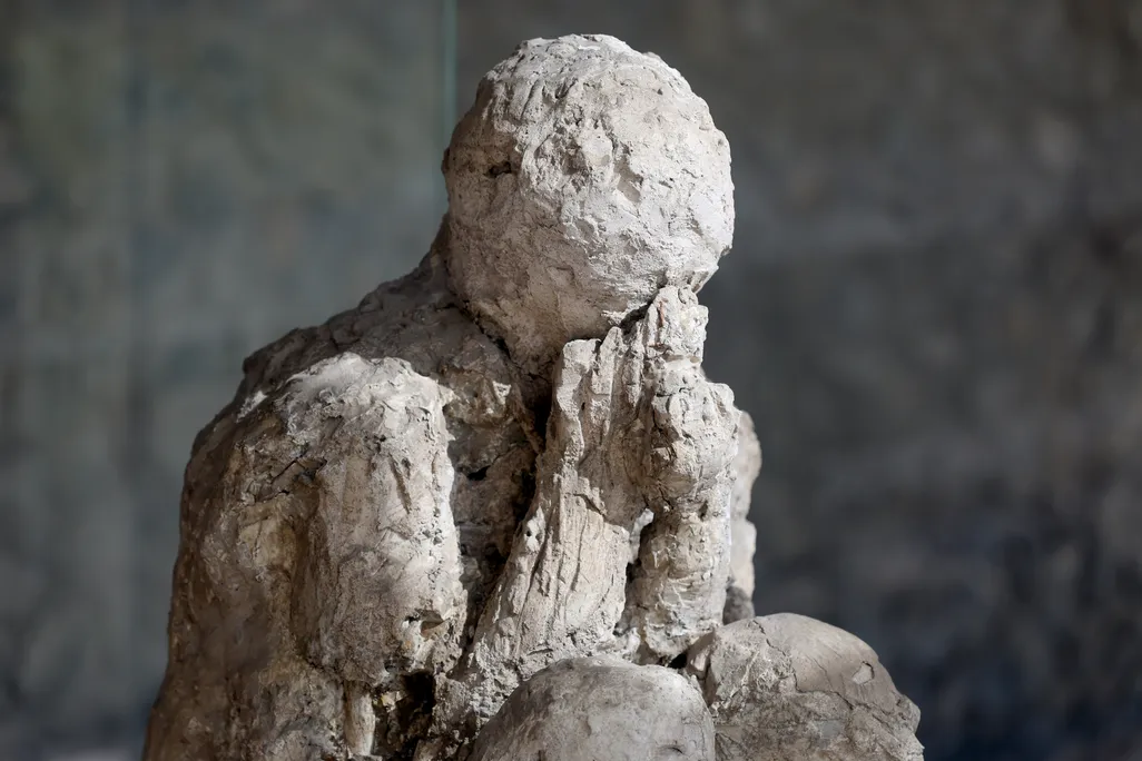 plaster cast