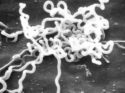 An image from an electron microscope of Treponema pallidum, the bacteria that causes syphilis. In 2022, the number of reported cases of syphilis in the United States was the highest it has been since 1950.