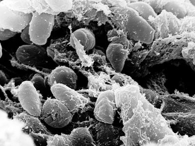 A scanning electron micrograph of Yersinia pestis bacteria