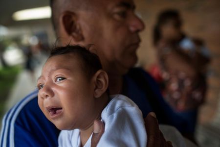Thousands of infants born in Brazil have been reported to show signs of microcephaly, like Alice pictured here being comforted by her father.