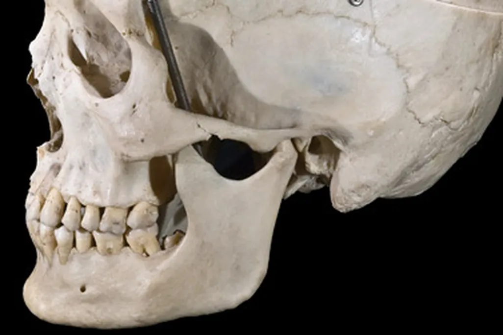 Humans are the only hominids with true chins.