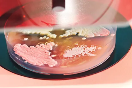 Strains of Streptomyces bacteria, found in soil, grow in a lab at Swansea University in Wales. They're so new to science they haven't been named. 