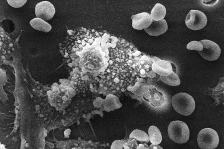 Macrophages begin to fuse with, and inject its toxins into, the cancer cell. The cell starts rounding up and loses its spikes.