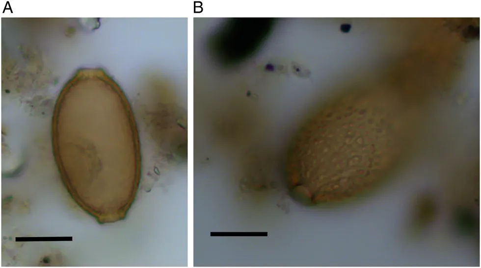 Microscopic view of capillariid eggs