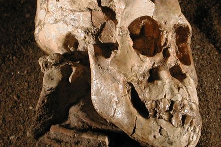 The 3.3-million-year-old fossils of an Australopithecus afarensis child from Dikika, Ethiopia, suggest the hominid climbed trees. The individual’s right shoulder blade (side view) is visible beneath the skull.