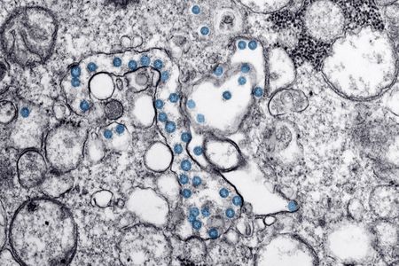 Microscope image of an isolate from the first U.S. case of Covid-19. Viral particles are visible in blue. 