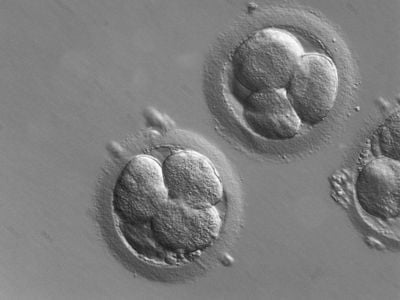 Early stage human embryos