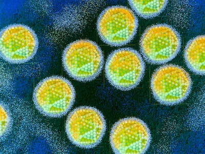 Color-enhanced transmission electron microscope images of adenovirus, which is a common cause of respiratory illnesses. Researchers identified adenovirus remnants, as well as herpesvirus and HPV, in Neanderthal remains in a new study.