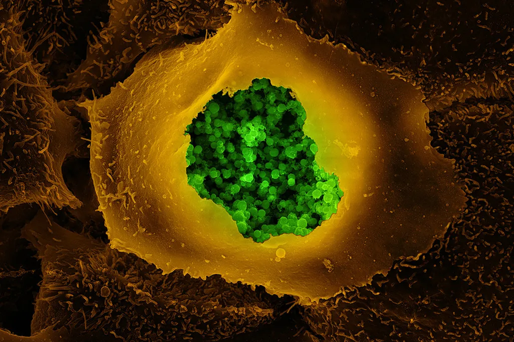 chlamydia