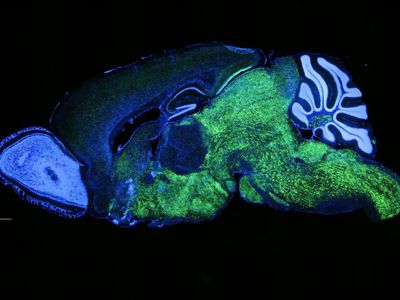 Cells producing the NOVA1 protein are shown in green in the brain of a mouse. A specific variant of this protein is unique to humans, and researchers suggest it is linked to spoken language development.