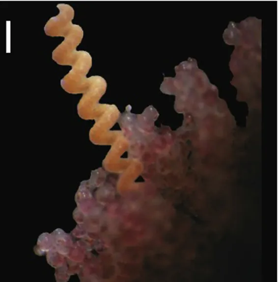 A parasitic ribbon worm, seen in this picture with the crab eggs it persists on.