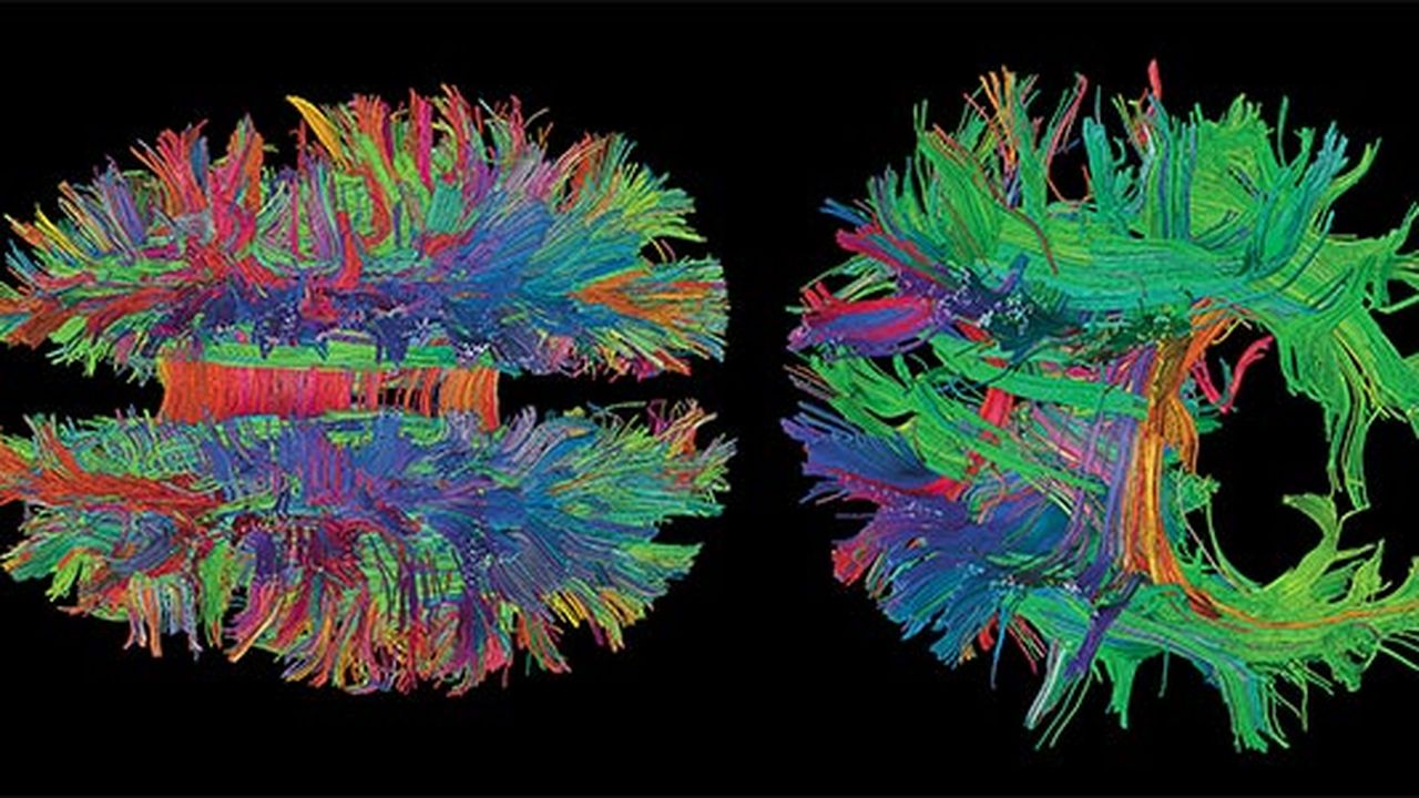 brains-magnetic-resonance-