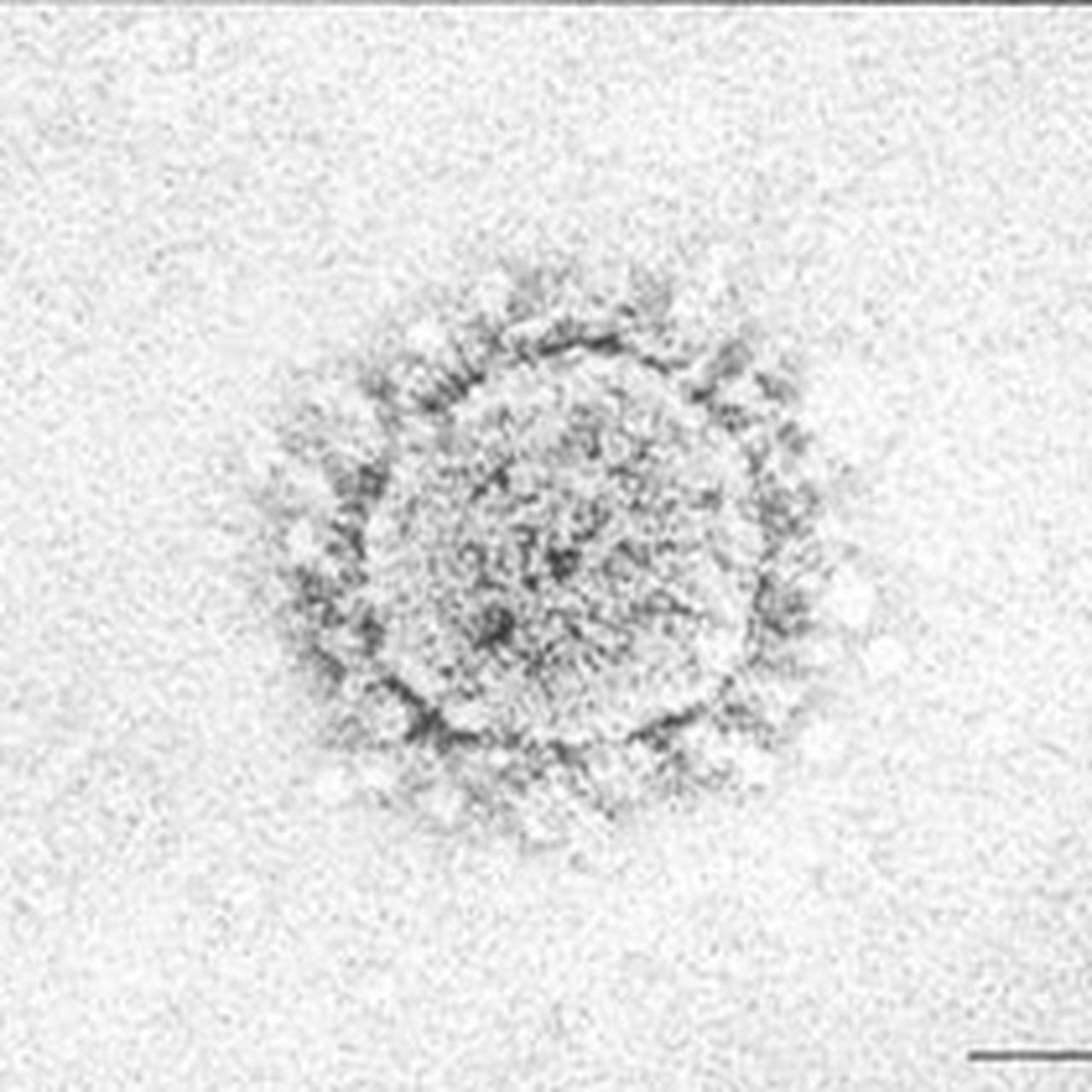 Microscopic Images Of Virus