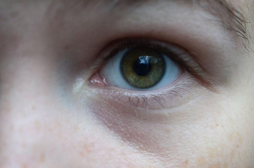 Eyeball