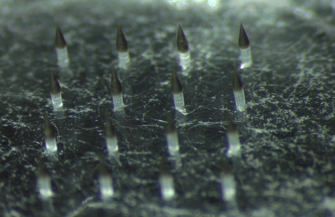 This Spiky Patch Could Invisibly Record Vaccination History Under Skin